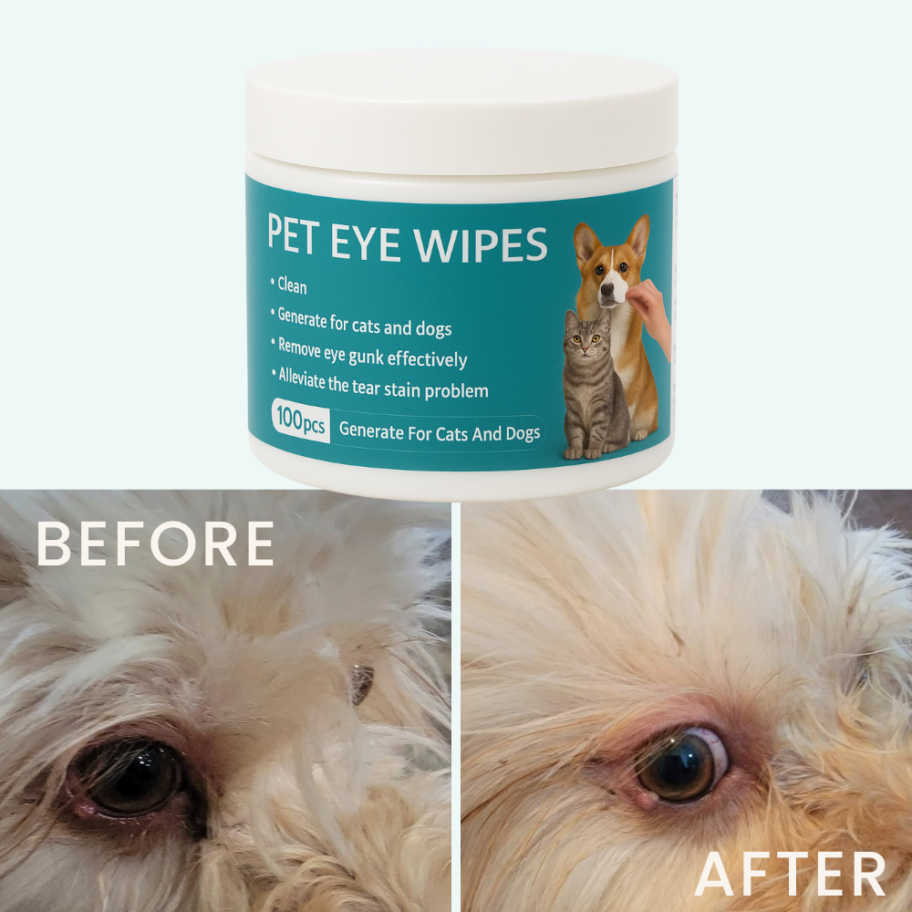 Kit EyeWipes – Protege contra problemas oculares