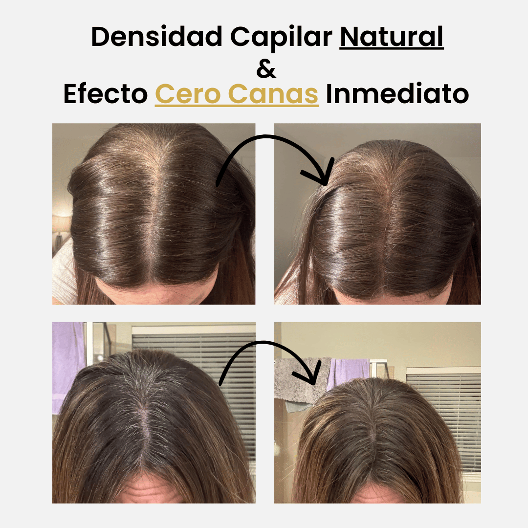 Driova - Cobertura Raíz Invisible