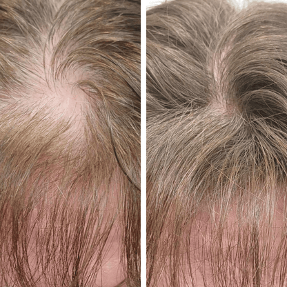 Driova - Cobertura de Raíz Invisible