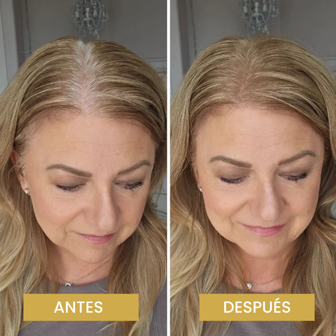 Driova - Cobertura de Raíz Invisible