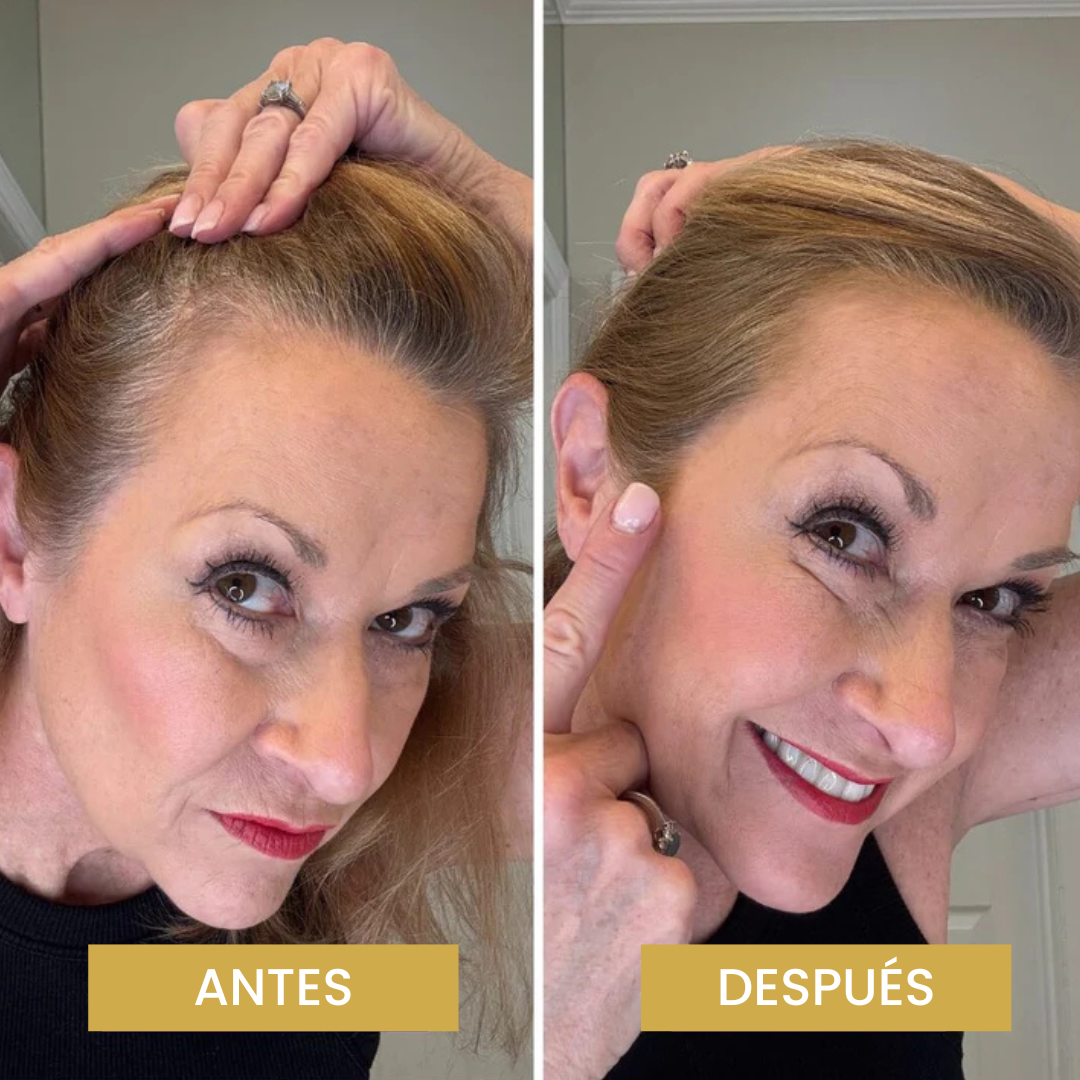 Driova - Cobertura de Raíz Invisible