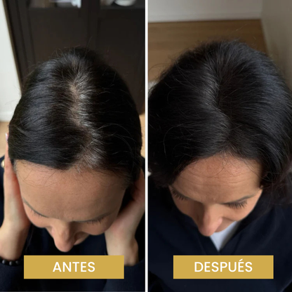 Driova - Cobertura de Raíz Invisible